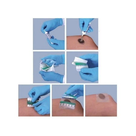 Medisorb G opatrunek hydrożelowy na rany martwicze 15 g 5 szt 15g